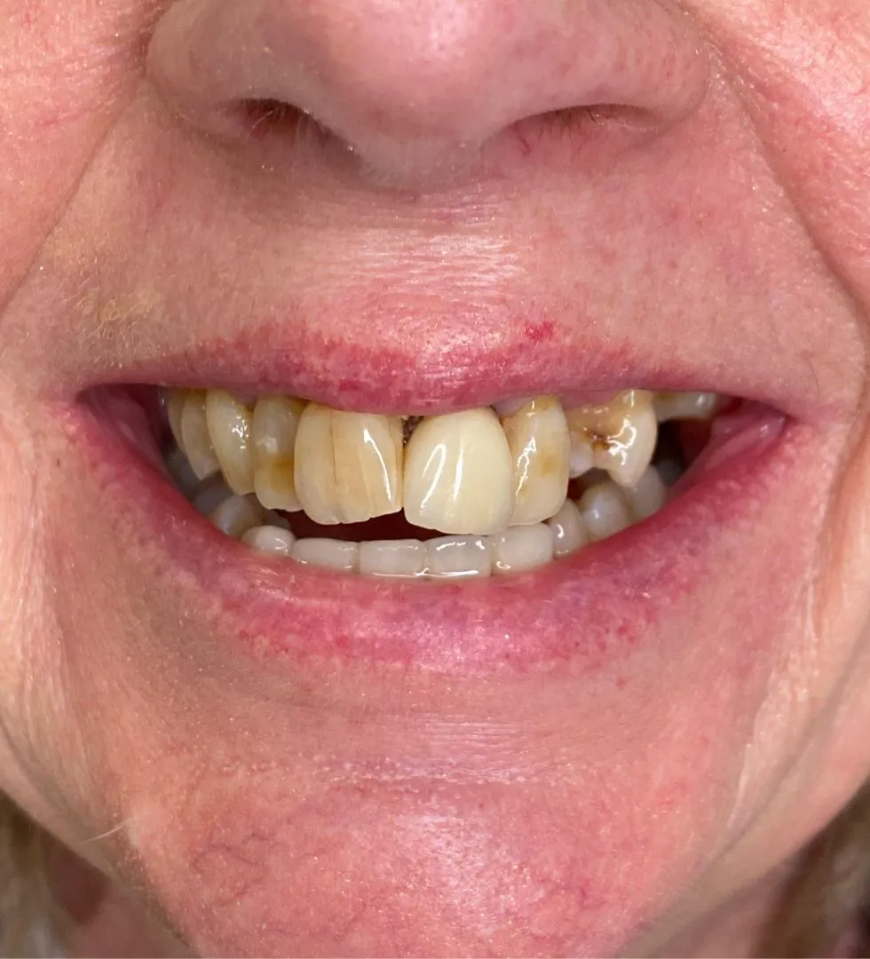 A excelência começa no detalhe