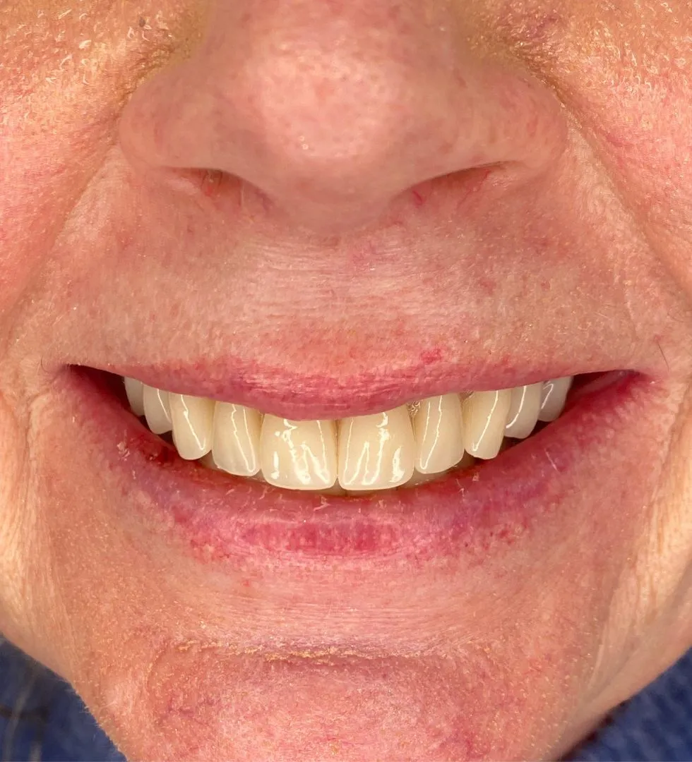 A excelência começa no detalhe